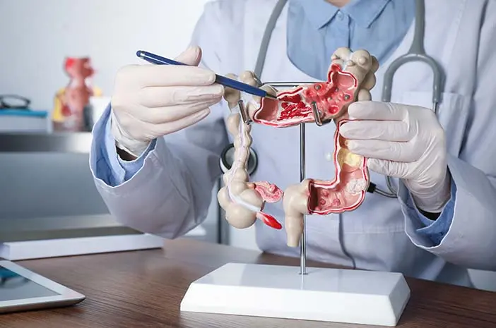 Google Image. Usus Besar pada Proses Pencernaan.